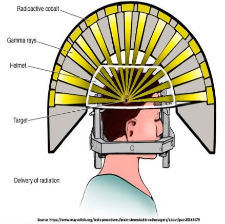 Stereotactic radiosurgery