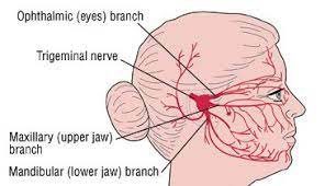 neuralgia and tooth pain