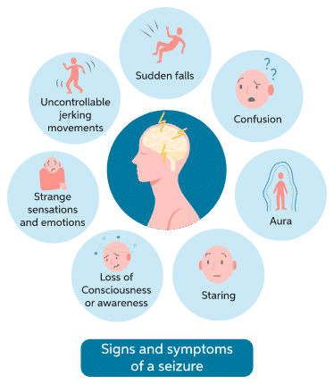 symptoms of a seizure