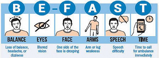 How does a mini-stroke affect life expectancy