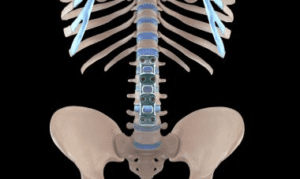 Is-It-Normal-to-have-Back-Pain-6-Months-After-Spinal-Fusion