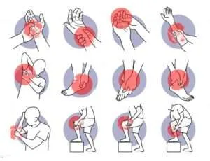 Symptoms of Spasticity | Gurneet