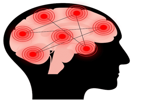 causes-of-seizures-in-alzheimers