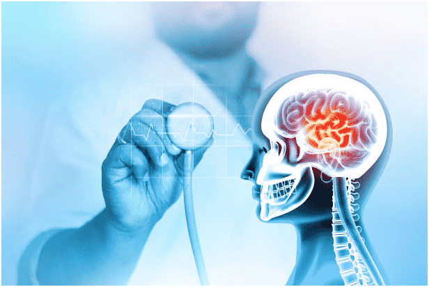 craniectomy-after-hemorrhagic-stroke-procedure