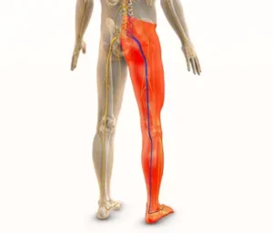 is-it-normal-to-have-sciatica-pain