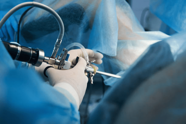 Minimally Invasive Endoscopic Surgery