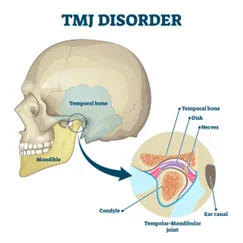 Temporomandibular Joint TMJ Disorders | Gurneet