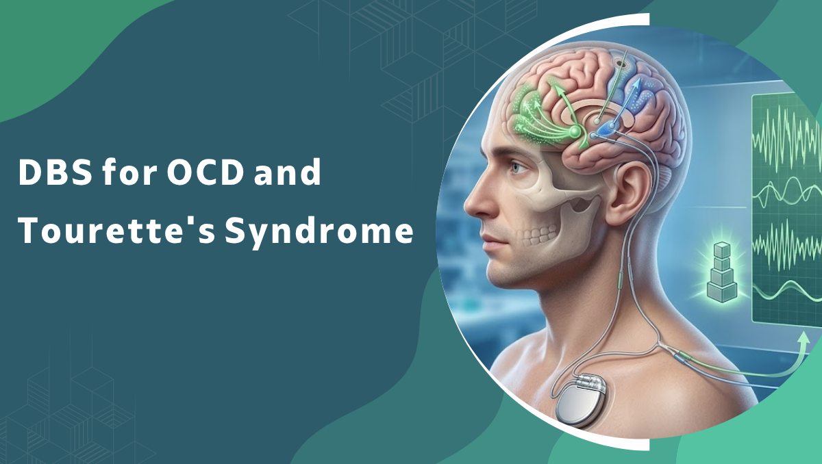 DBS for OCD and Tourettes Syndrome