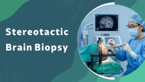 Stereotactic Brain Biopsy