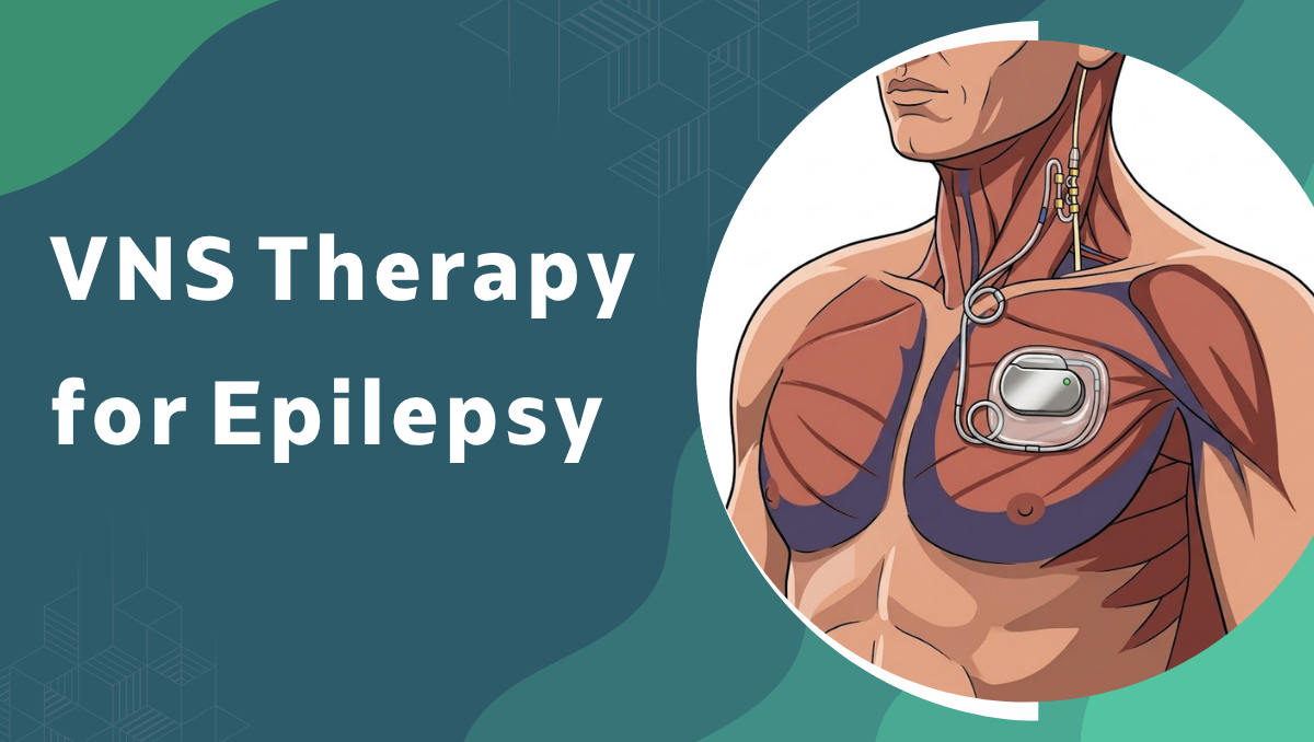 VNS Therapy for Epilepsy
