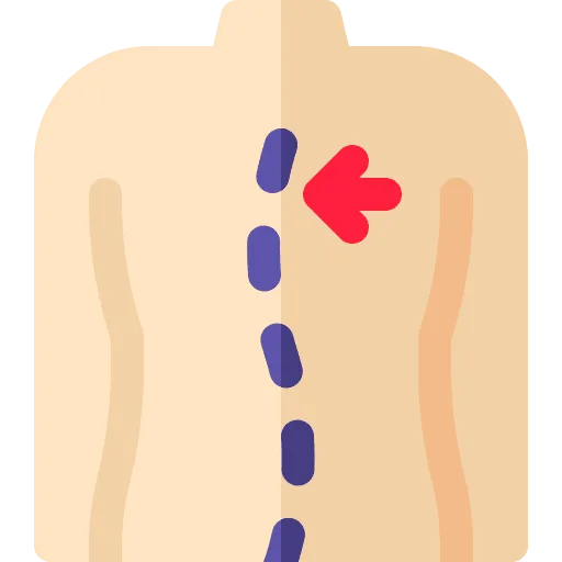 Back view of a torso with a dotted blue spine and a red leftward arrow, indicating spinal deviation (scoliosis)