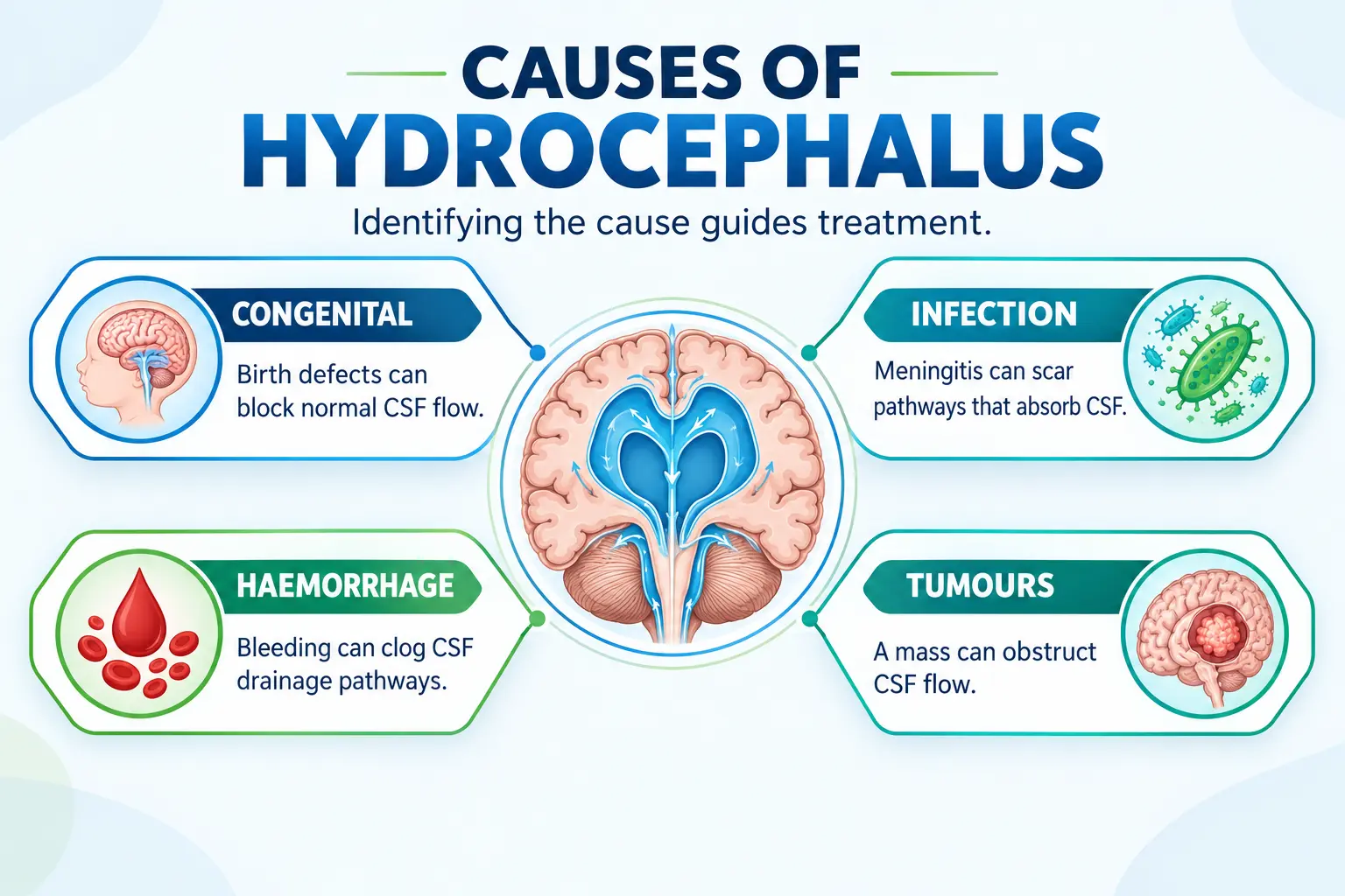Causes of Hydrocephalus Infographic | Gurneet Causes of Hydrocephalus Infographic