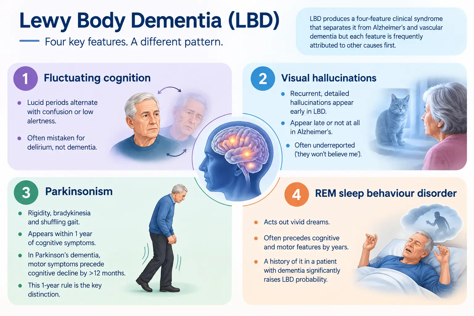 Lewy Body Dementia Four Key Features | Gurneet Lewy Body Dementia Four Key Features