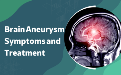 What Are the Symptoms, Causes, and Treatment of a Brain Aneurysm?
