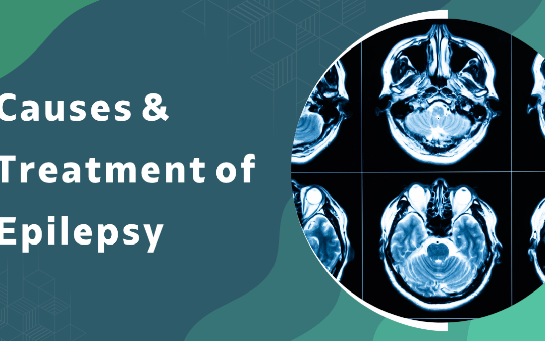 Causes Treatment of Epilepsy