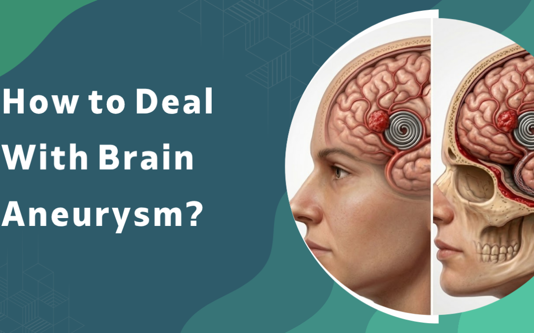 How to Deal With Brain Aneurysm