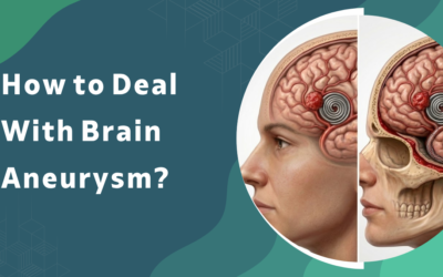 How to deal with Brain Aneurysm?