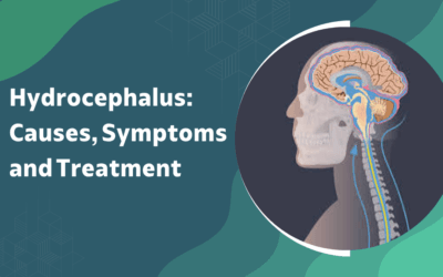 Hydrocephalus: What Causes, Symptoms and Treatment?