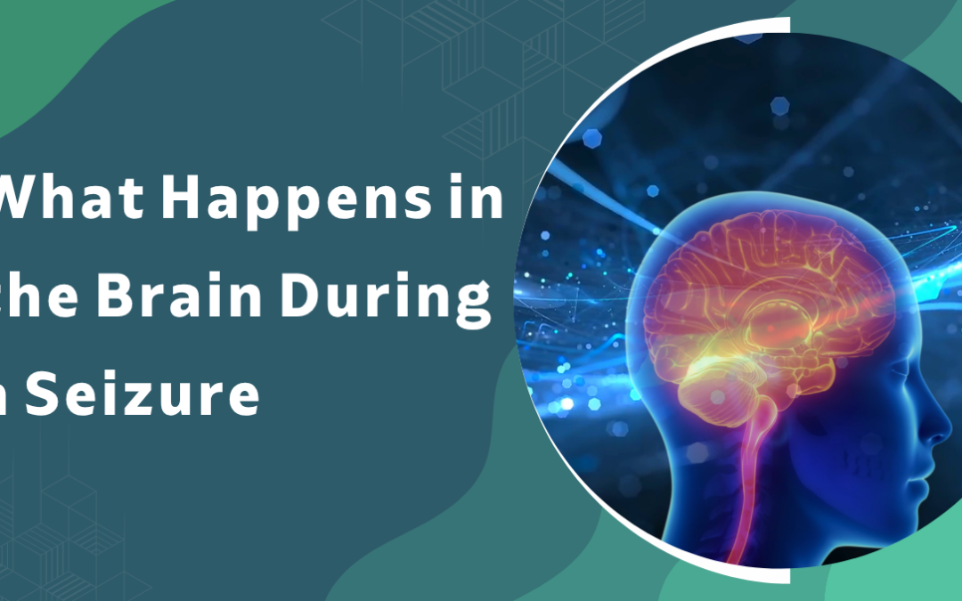What Happens in the Brain During a Seizure