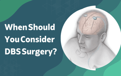 When Should You Consider A DBS Surgery?