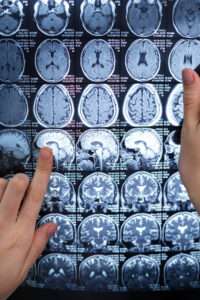 doctor-looking-ct-scan