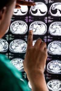 doctor-reading-brain-mri-x-ray-result