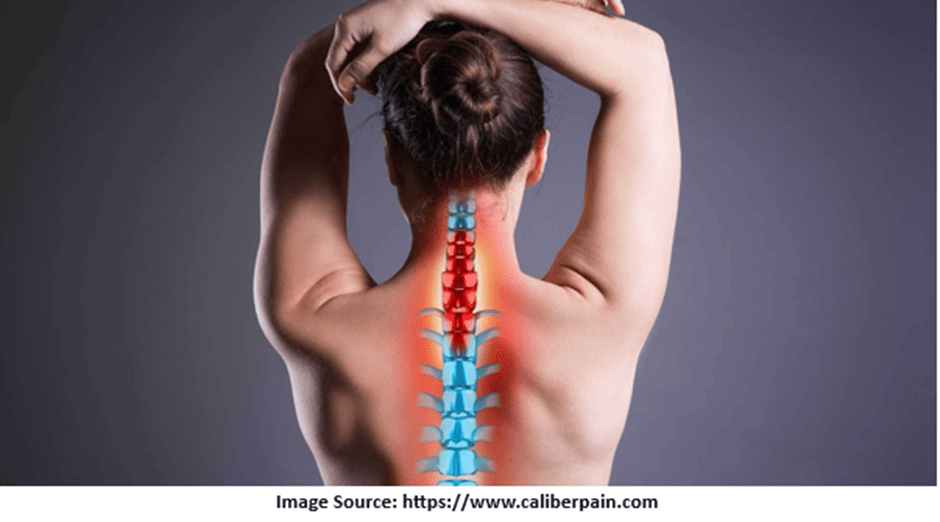 Cervical Spinal Cord Stimulation