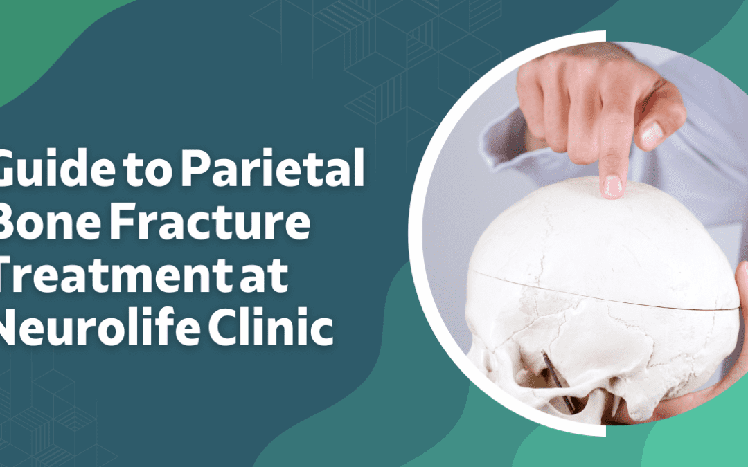 Parietal Bone Fracture Treatmen