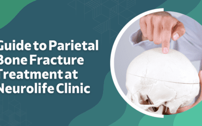 Guide to Parietal Bone Fracture Treatment at Neurolife Clinic