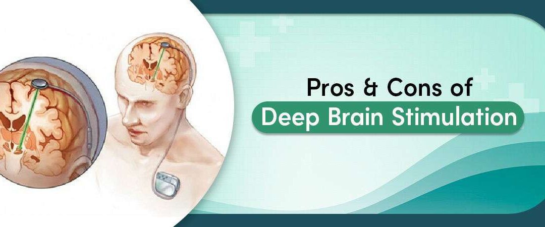 Pros and Cons of Deep Brain Stimulation