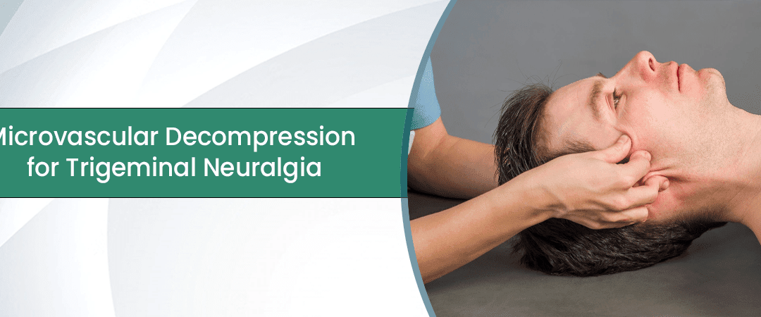 Microvascular Decompression for Trigeminal Neuralgia