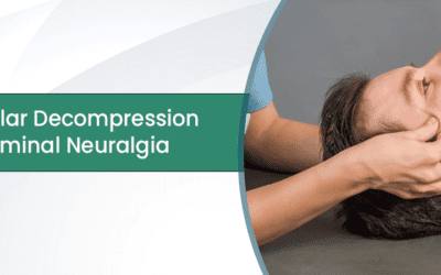 Microvascular Decompression for Trigeminal Neuralgia