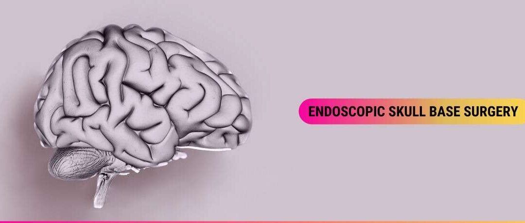 Endoscopic Skull Base Surgery