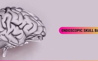 Endoscopic Skull Base Surgery