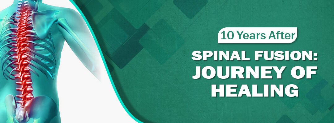 10 Years After Spinal Fusion: Journey of Healing