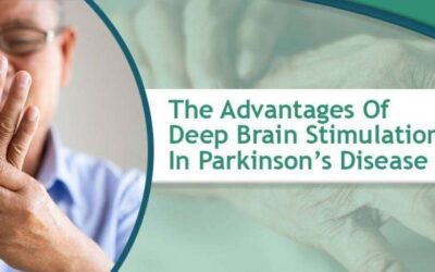 The Advantages Of Deep Brain Stimulation (DBS) In Parkinson’s Disease