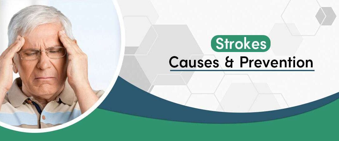 Strokes: Causes And Prevention