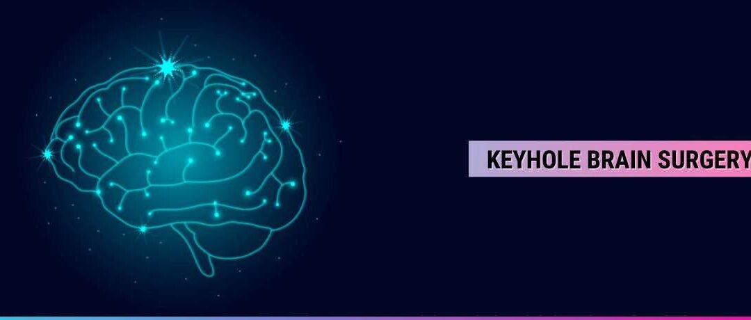 What Is Keyhole Brain Surgery – Benefits & Treatment In Mumbai