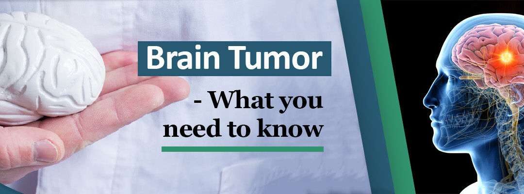 Brain Tumor – What You Need To Know