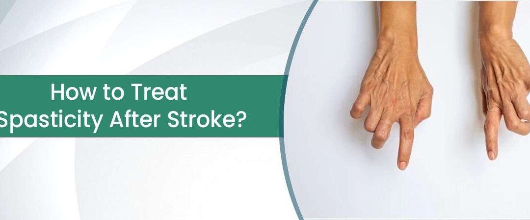 How to Treat Spasticity After Stroke?