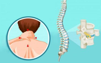 Who Can Go For Spinal Cord Stimulation?