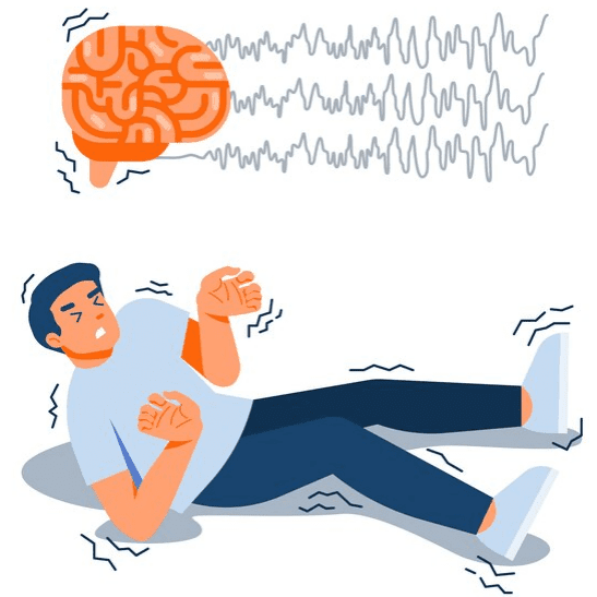 Dystonia-and-Seizures