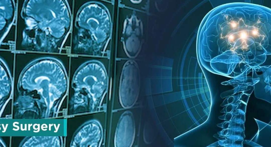 Epilepsy & Seizures