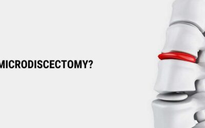 Microdiscectomy – How It Can Help Relieve Sciatica?