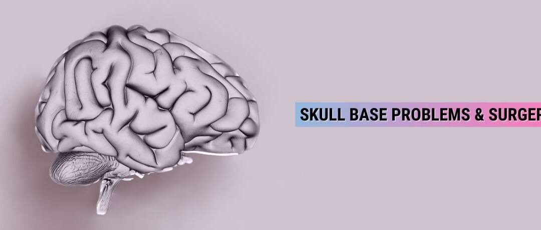 Diagnosis Of Skull Base Problems & Surgery Types