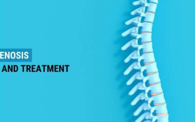 Spinal Stenosis Diagnosis And Treatment