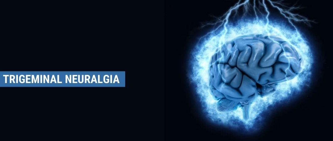 Trigeminal Neuralgia