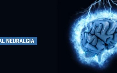 Treatments for Trigeminal Neuralgia