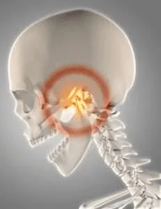 skull fracture | Gurneet skull fracture