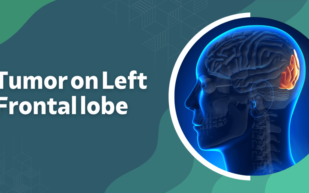 Tumor on Left Frontal Lobe